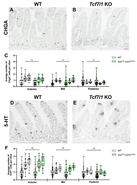 TCF7L1 Controls the Differentiation of Tuft Cells in Mouse Small Intestine