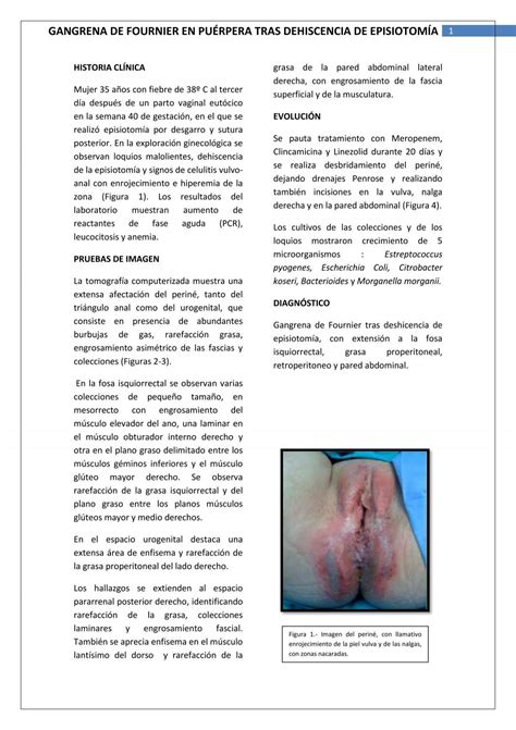 gangrena de fournier en puérpera tras dehiscencia de episiotomía