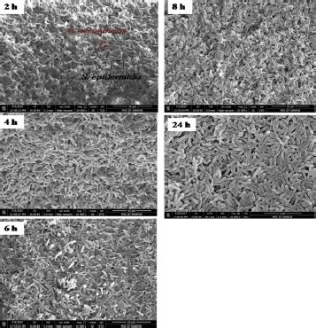The effect of Staphylococcus epidermidis cells on Pseudomonas ...