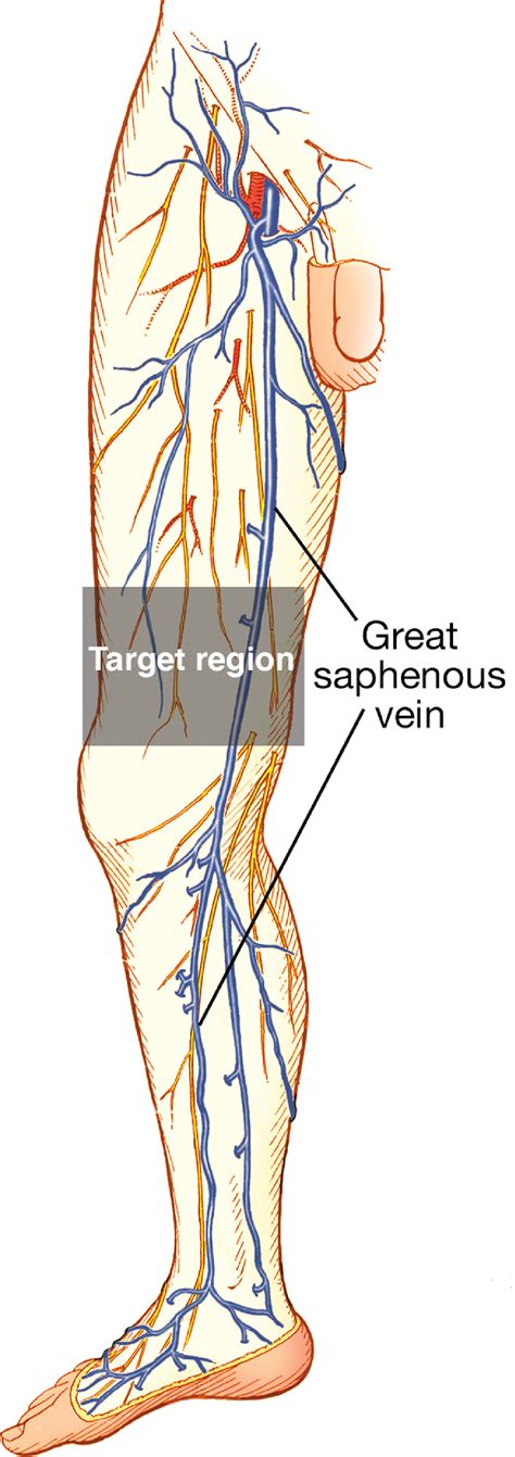 Ultrasound-Guided Great Saphenous Vein Access: Revisiting an Old Friend in a New Location ...