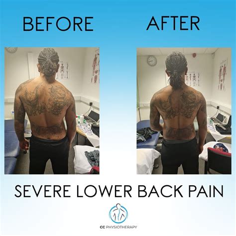 Why Does My Back Feel Worse After Physio?