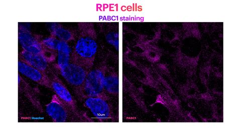 PABPC1,PABP antibody (10970-1-AP) | Proteintech