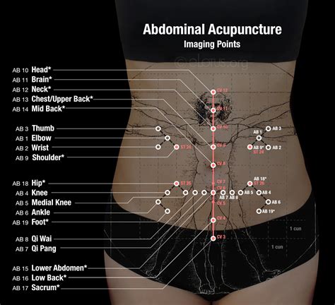 Acupuncture 的图像结果