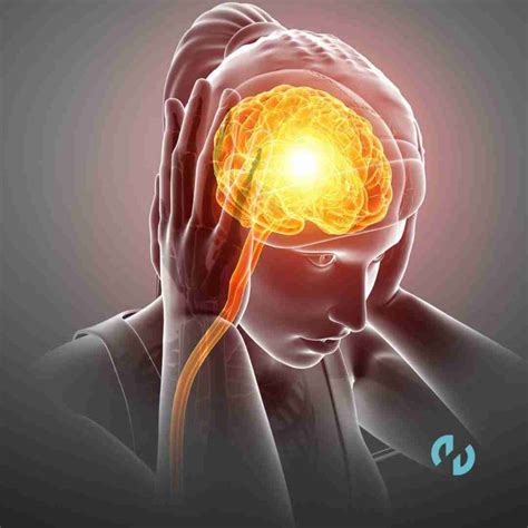 Cefalea tensional, ¿Qué es y cómo tratarla?