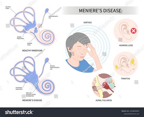 Ear Humming And Headache