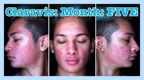 Image result for Claravis Compounding Powder