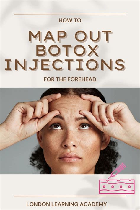 Image result for Botox Forehead Injection Sites Tutorial
