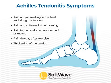 Shockwave Therapy for Achilles Tendonitis | SoftWave