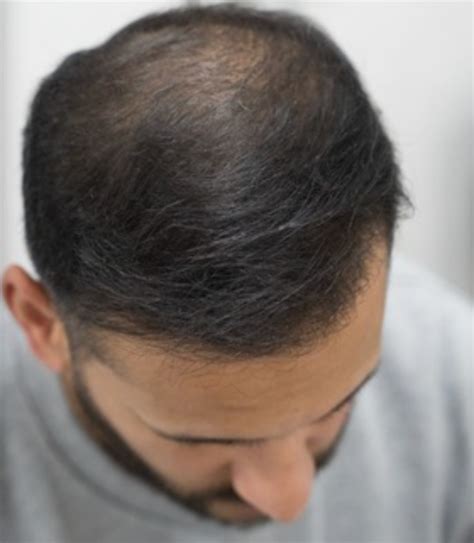 Image result for Vortex Braid