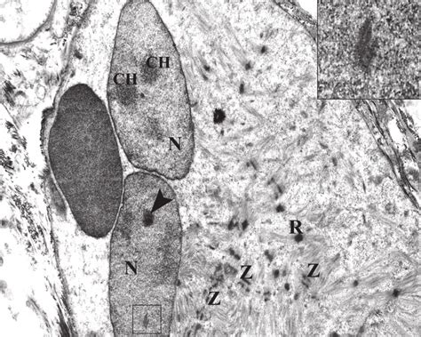 Image result for Muscle Fiber Z-Line