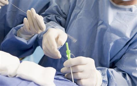 Image result for Interventional Procedure