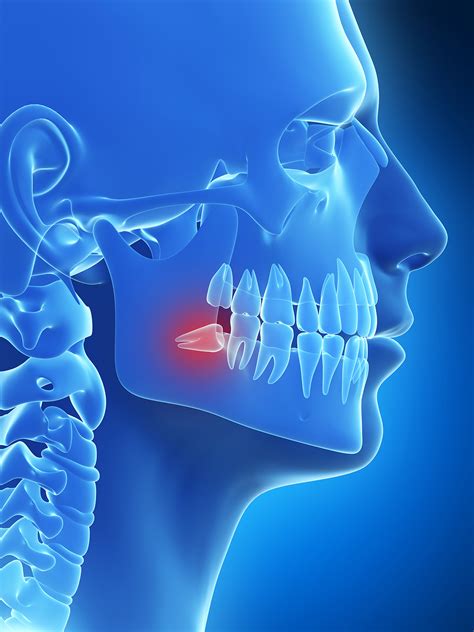 When Do Wisdom Teeth Grow - tearsandhope.com