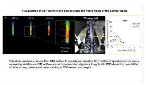 Visualization of Cerebrospinal Fluid Outflow and Egress along the Nerve ...
