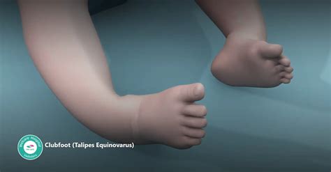 પગ અને ઘૂંટી