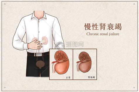 如何早发现肾脏病风险？这些检查很重要 - 特色门诊 - 健康时报网_精品健康新闻 健康服务专家