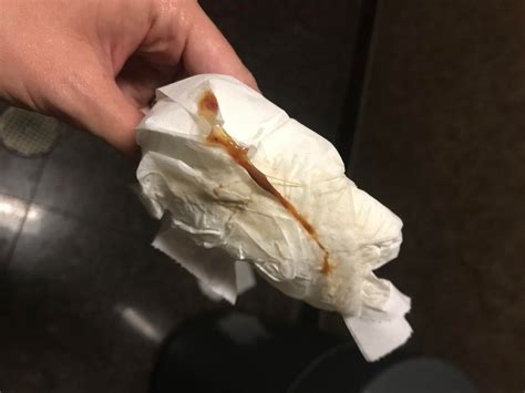 Spottinh After Cervix Check Colposcopy: Uses, Side Effects, Procedure,