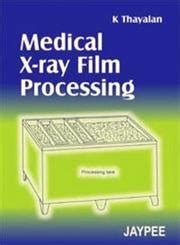 Medical X-Ray Film Processing : Thayalan: Amazon.in: Industrial ...