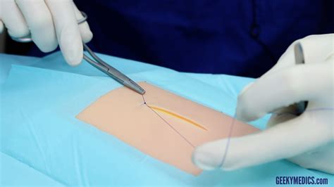 Basic Interrupted Suture 的图像结果