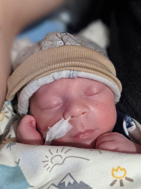 31 Weeks Premature Baby