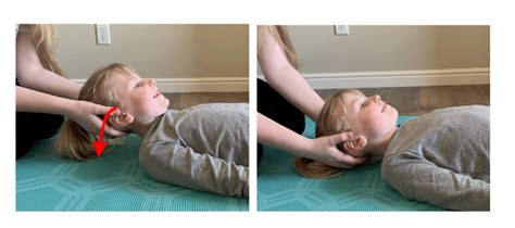 Moro Reflex Testing 的图像结果