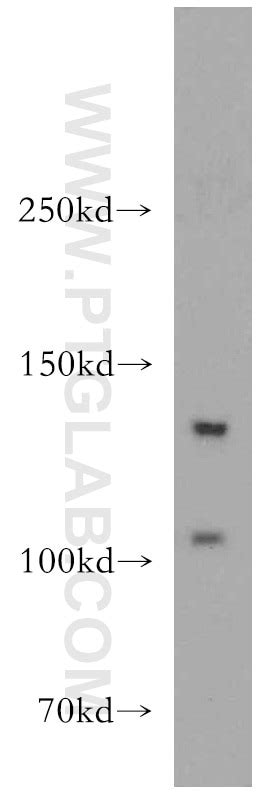TGFBR3-Specific antibody (20000-1-AP) | Proteintech