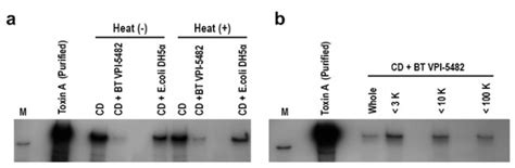 The Human Gut Microbe Bacteroides thetaiotaomicron Suppresses Toxin ...
