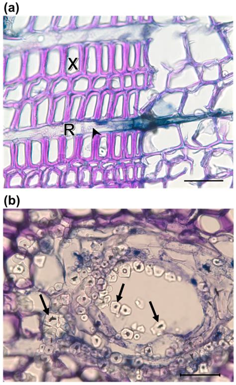 Anatomical and Chemical Responses of Eastern White Pine (Pinus strobus ...