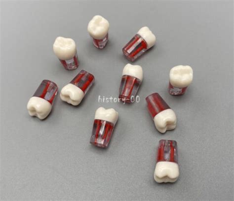 New Dental Root Canal RCT Practice Pulp Cavity Resin | Ubuy India