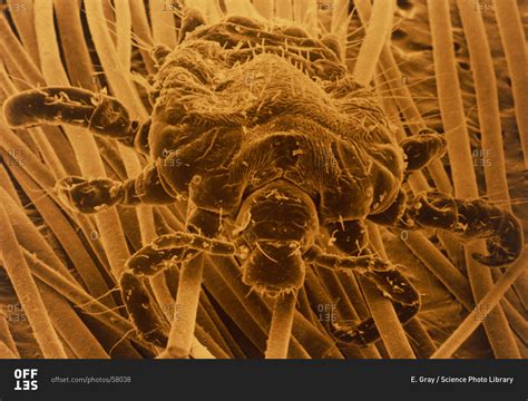Color scanning electron micrograph of pubic louse (Phthirus pubis), also known as the crab louse ...