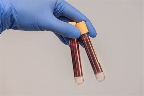 What Is PCR Test 的图像结果