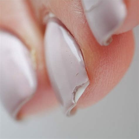 Der Traum von festen Nägeln: Was kannst du gegen brüchige Fingernägel ...