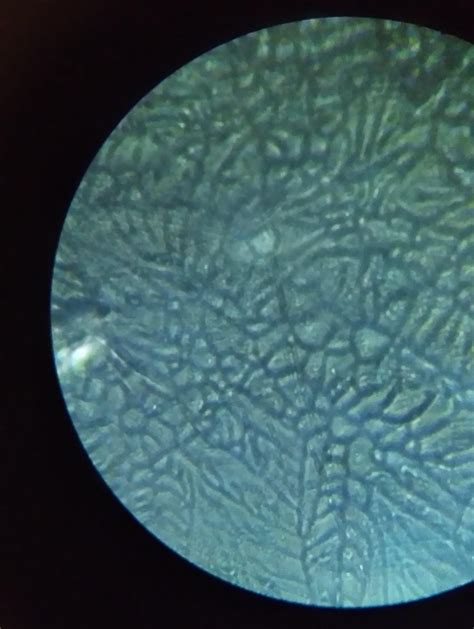 Osmium's beautiful crystal structure as seen through a microscope. : r ...