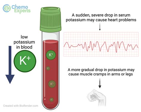 Low Blood Potassium (hypokalemia) | ChemoExperts