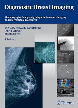 Diagnostic Breast Imaging: Mammography, Sonography, Magnetic Resonance ...