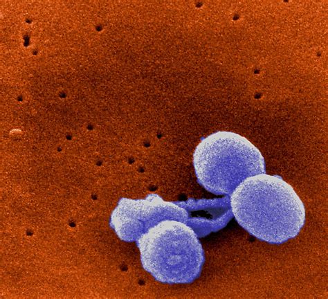 Haemophilus Influenzae Type B Symptoms