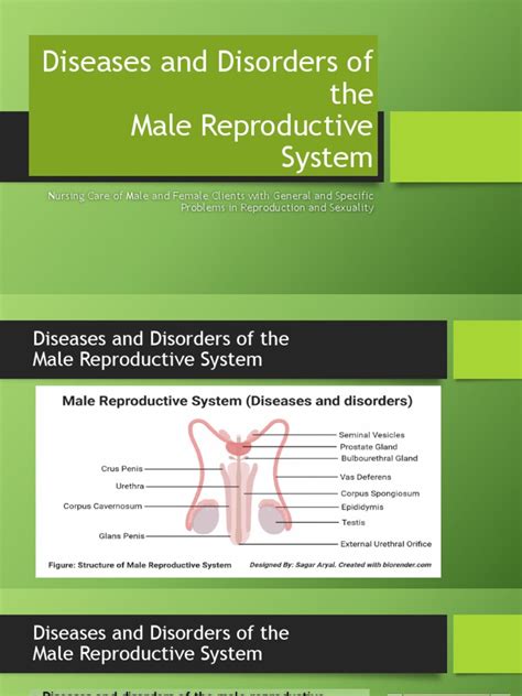 Male Reproductive System Disorders 的图像结果