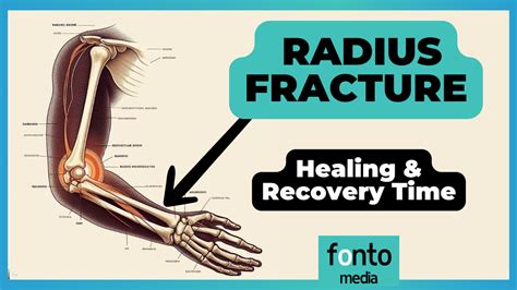 Radius Fracture 的图像结果
