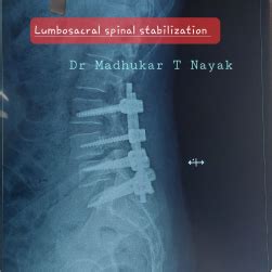 Dr Madhukar T Nayak, Neurosurgeon - Navi-Mumbai