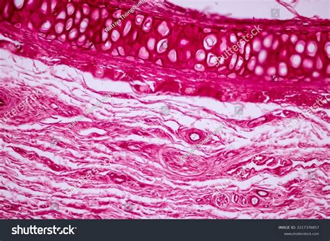 Elastic Cartilage Under Microscope