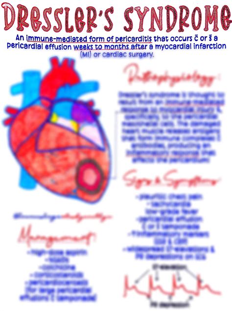 Dressler’s Syndrome: What Does *** Want All Patients To Know? - Open ...
