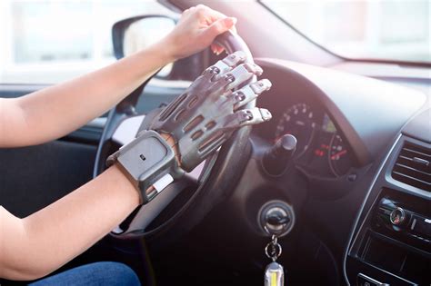 How Do Prosthetic Arms Work? Guide to Modern Arm Prosthetics