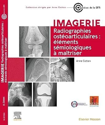 Radiographies ostéoarticulaires : éléments sémiologiques à maitriser ...