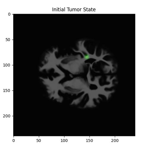 Image result for Tumor Segmentation Using Python