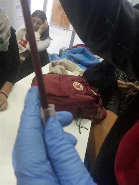 HEMATOLOGIA: PRACTICA 19: VELOCIDAD DE SEDIMENTACIÓN GLOBULAR.