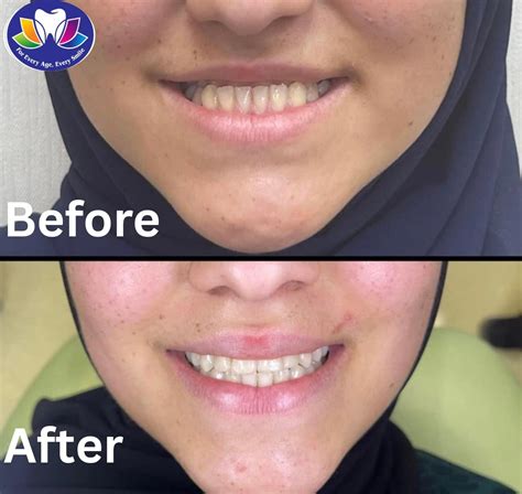 Lotus Family Dental - Advanced Dental Care & Smile Specialists