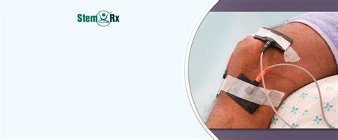 Transcutaneous Electrical Nerve Stimulation (TENS) at StemRx Hospital ...
