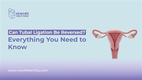 IVF Medication List: What You’ll Need and Why