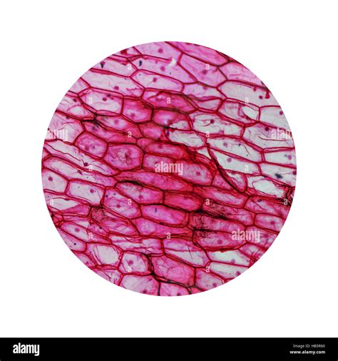 Onion Skin Cell Labeled
