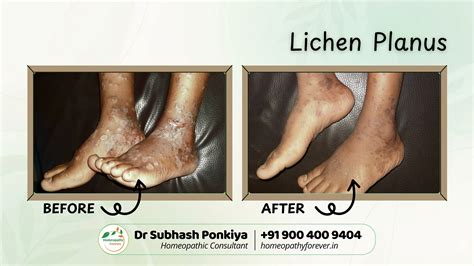 Homeopathy Forever | Best Homeopathic Clinic in Rajkot – Dr. Subhash ...