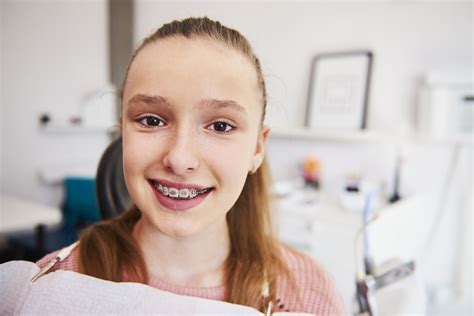 Nhs Braces Before And After at Sara Sheridan blog